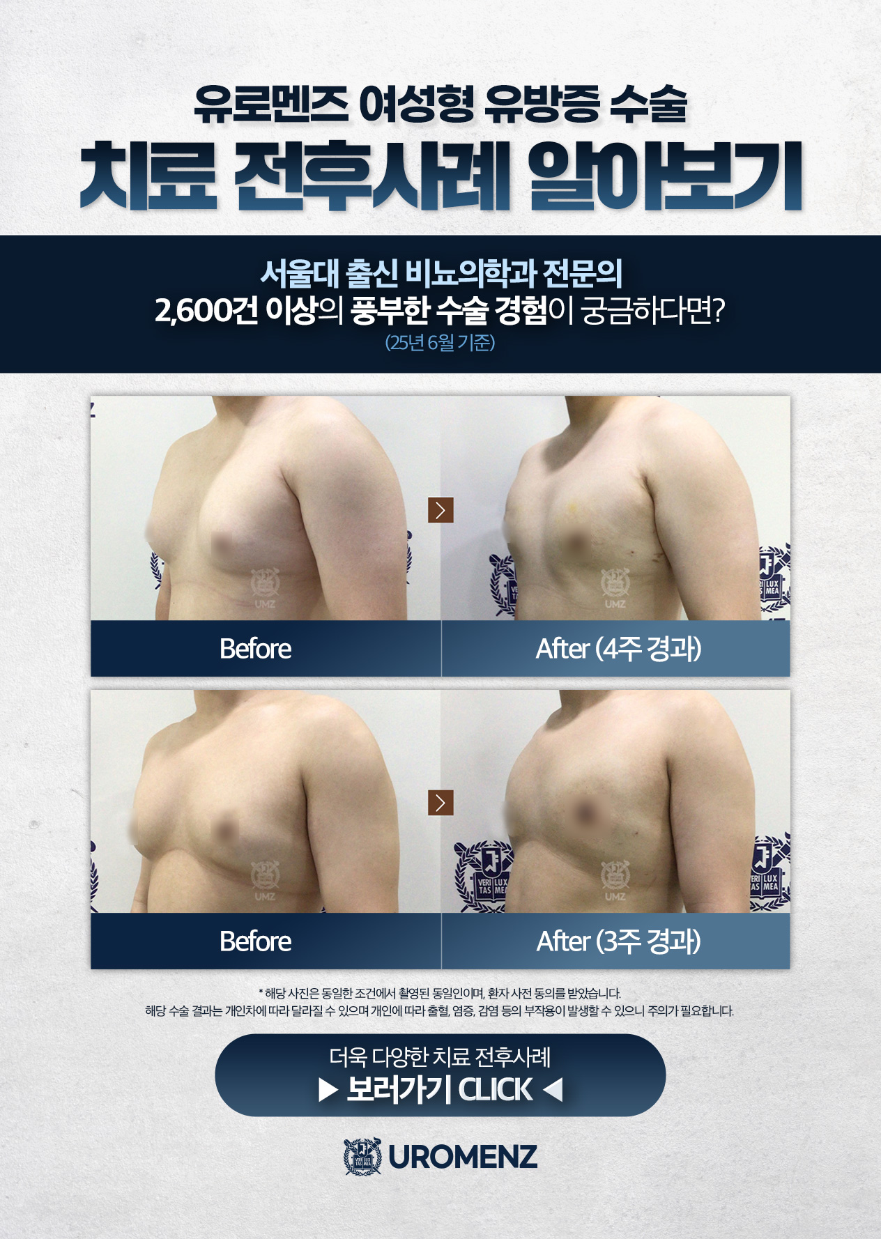 유로멘즈남성의원 | 부산여유증 | 서면여유증 | 부산서면남성의원